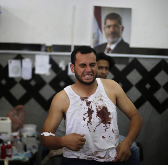 A wounded Morsi supporter reacts at a local hospital in Cairo