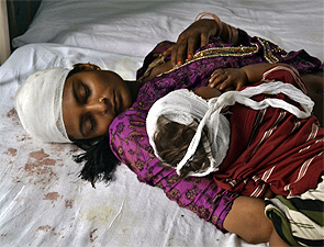A woman and her child, injured in communal clashes in Muzaffarnagar.