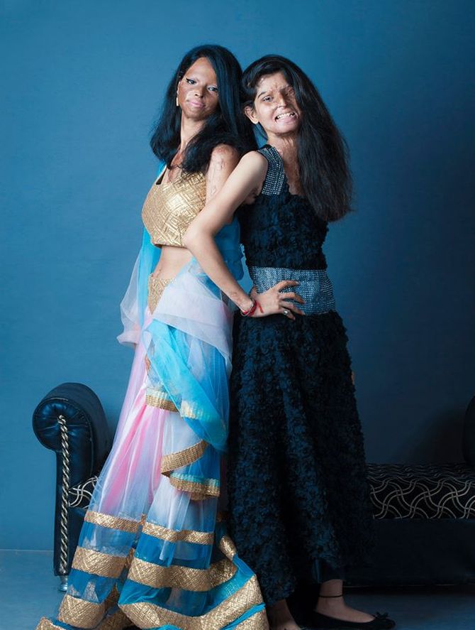 Faces of courage: Acid attack victims stand tall in photoshoot