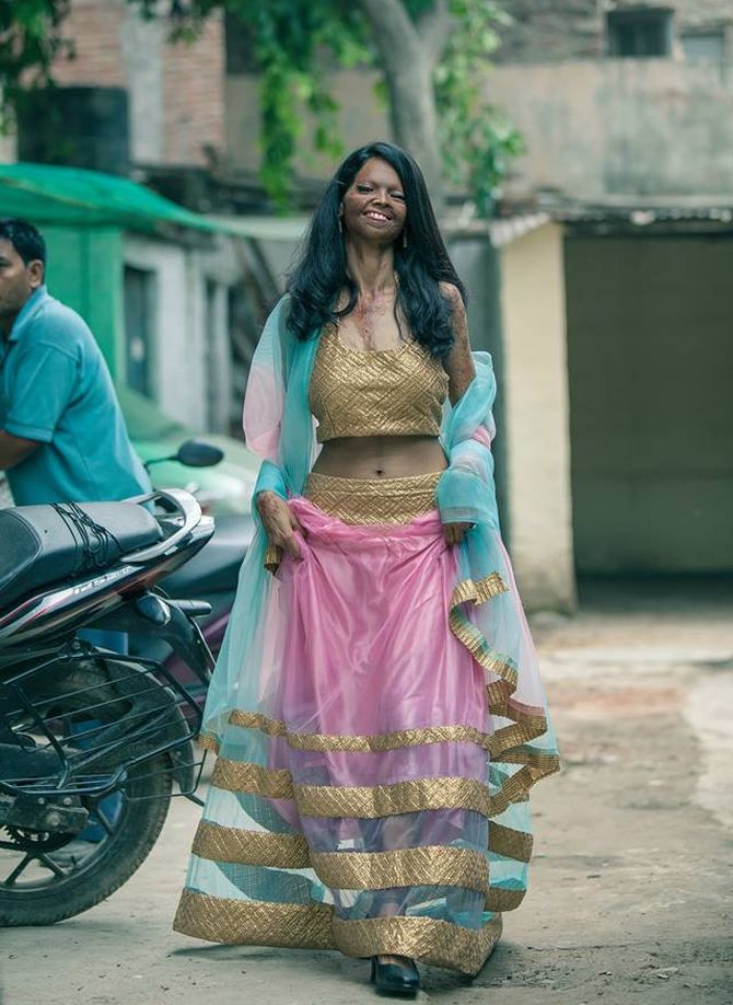 Faces of courage: Acid attack victims stand tall in photoshoot