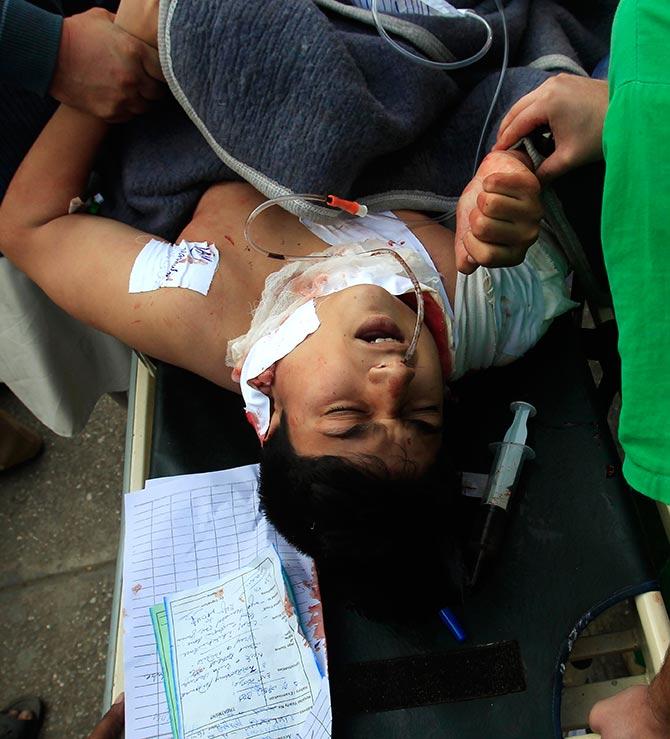 The heartbreaking sight of a child injured in the Peshawar school attack 