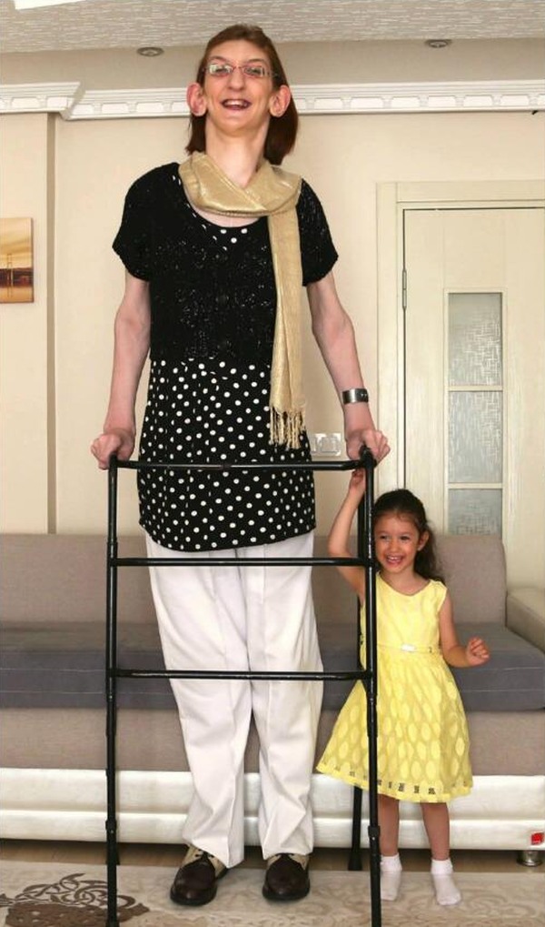 Meet Rumeysa Gelgi, world's tallest teenage girl