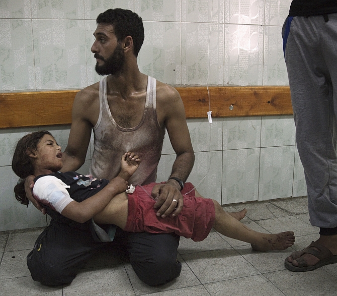 A Palestinian man holds a girl, whom medics said was injured in an Israeli shelling at a UN-run school sheltering Palestinian refugees, at a hospital in the northern Gaza Strip