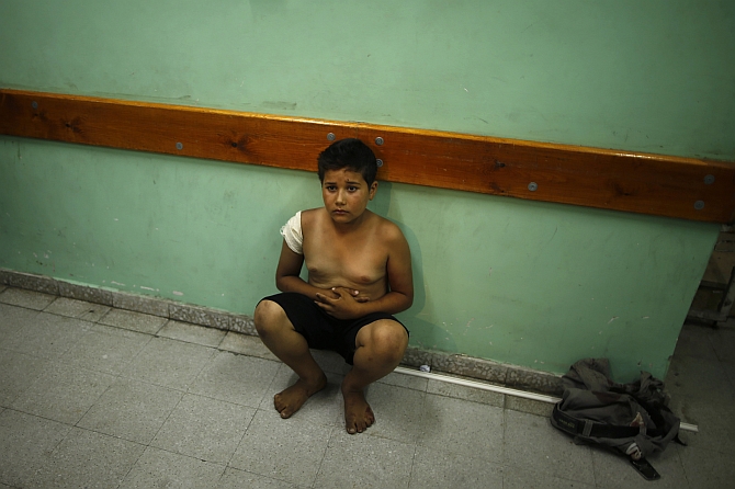 A Palestinian boy injured in the shelling sits in a hospital in Gaza