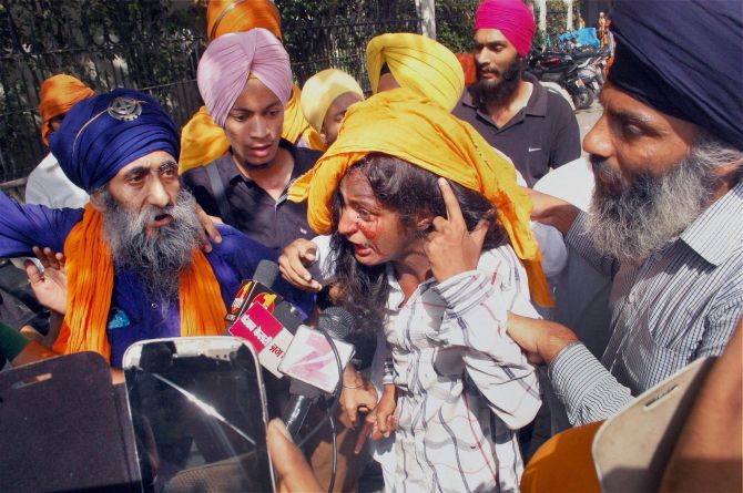 A woman shows her injury to the media after a clash between SGPC and members of a radical Sikh organisation on the 30th anniversary of Operation Bluestar, at Golden Temple Complex in Amritsar