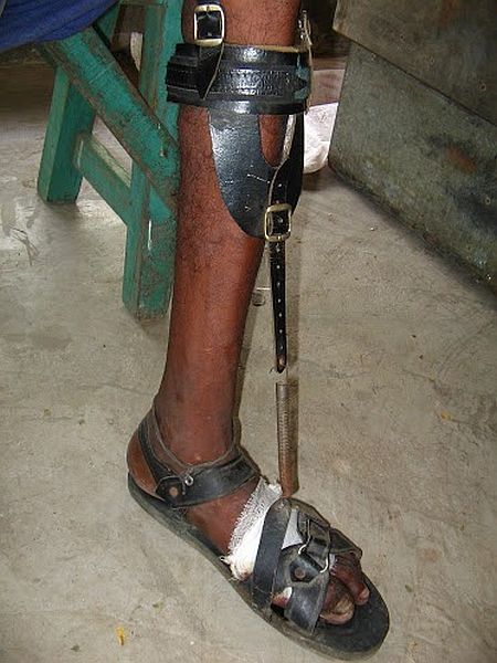 Calcutta Rescue makes shoes like this for leprosy patients