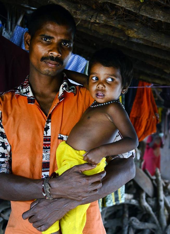 The malnourished children of Maharashtra's Mokhada