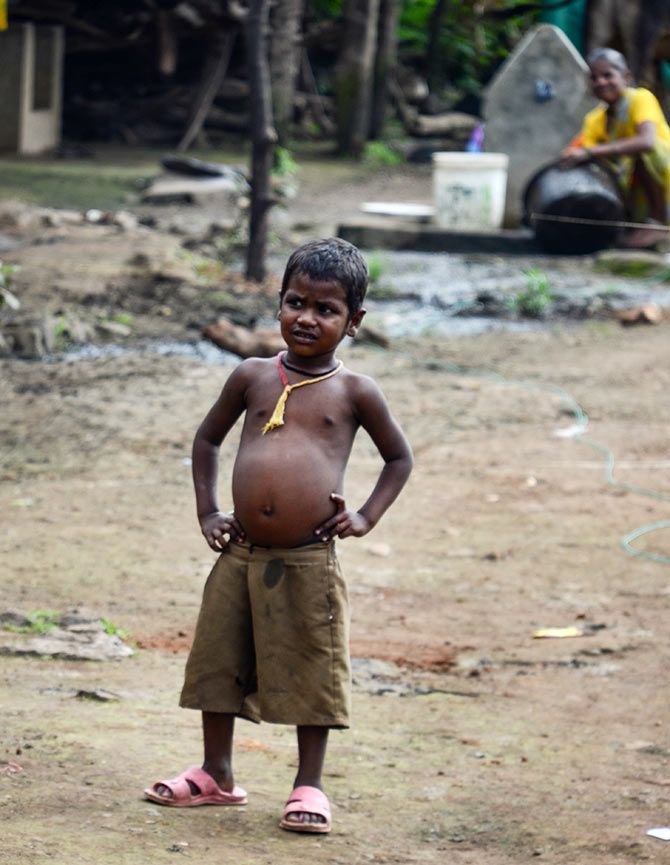 The malnourished children of Maharashtra's Mokhada