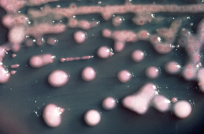 Klebsiella pneumoniae, the bacterium in which superbug NDM-1 was first identified. 