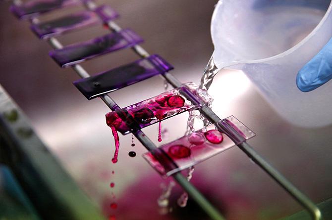 A health technician analyses blood samples for tuberculosis testing in a high-tech tuberculosis lab. Photograph: Mariana Bazo/Reuters.