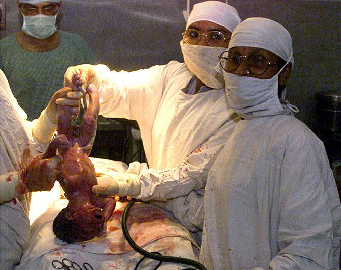 A baby is born in Kolkata. Photograph: Jayanta Shaw/Reuters.