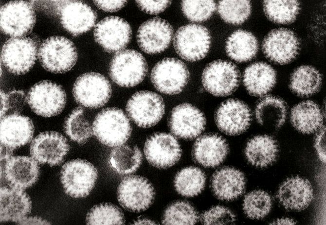 Rotavirus in a child's stool sample. Photograph