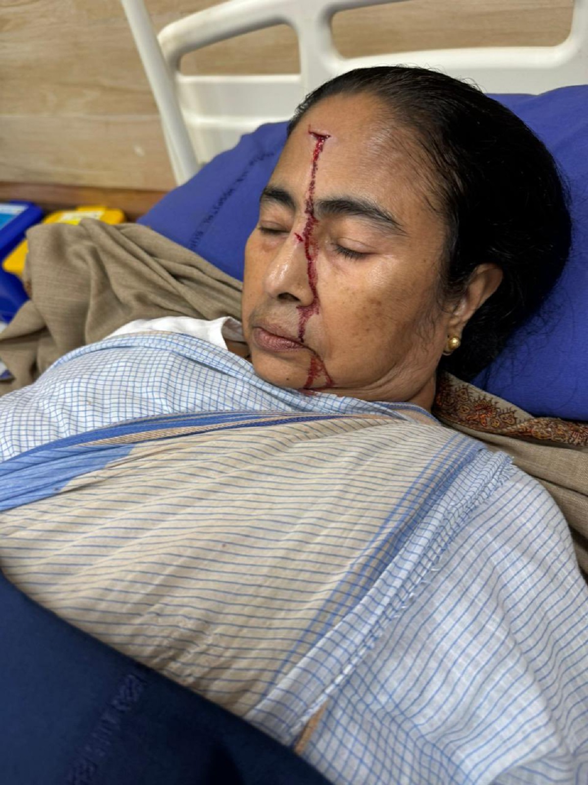 Mamata has a fall, injured, rushed to hospital