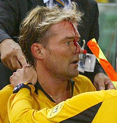 Swedish referee Anders Frisk receives attention after been injured