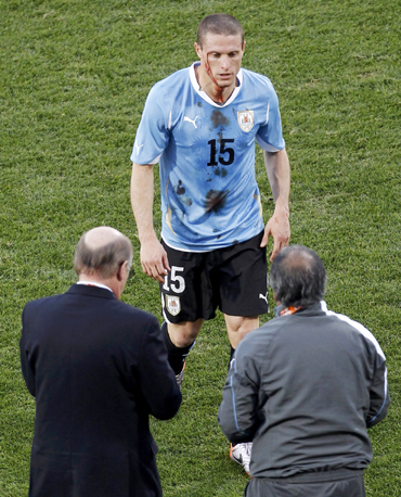 Uruguay's Diego Perez walks off the field after he was injured during a 2010 World Cup Group A soccer match against Mexico at Royal Bafokeng stadium in Rustenburg
