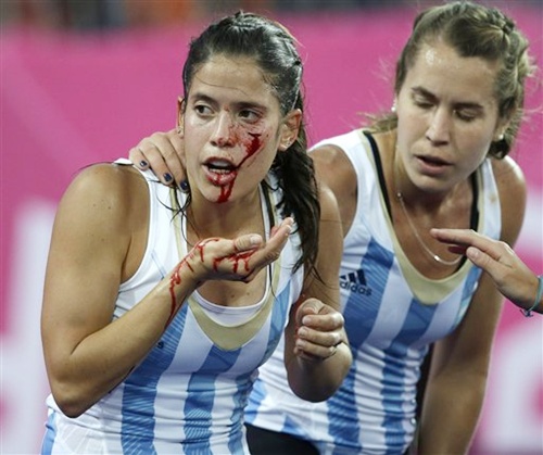 Photos: Braving pain for Olympic glory