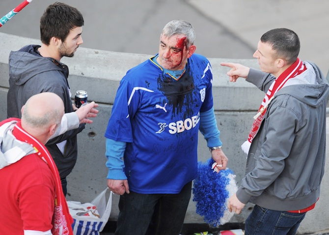 A bloodied Cardiff City fan looks on after a clash with Liverpool fans