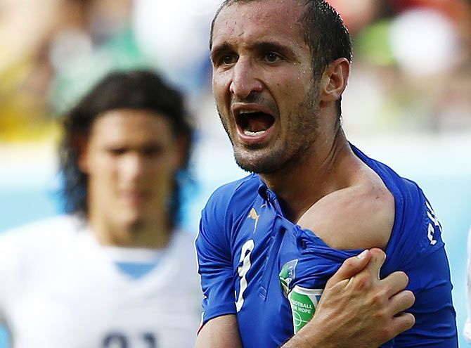 Italy's Giorgio Chiellini shows his shoulder, claiming he was bitten by Uruguay's Luis Suarez during their 2014 FIFA World Cup group stage match