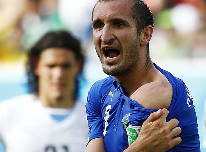 Italy's Giorgio Chiellini shows his shoulder, claiming he was bitten by Uruguay's Luis Suarez during their match