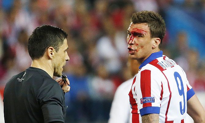 Atletico Madrid's Mario Mandzukic remonstrates with referee Milorad Mazic as he walks off the pitch to receive treatment after sustaining a head injury against Real Madrid during their UEFA Champions League first leg quarter-final match at the Vicente Calderon, in Madrid on April 14