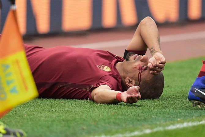 AS Roma full-back Emerson is left bloodied on the pitch during the ill-tempered Serie A derby match against SS Lazio at Olympic Stadium, Rome, on Sunday