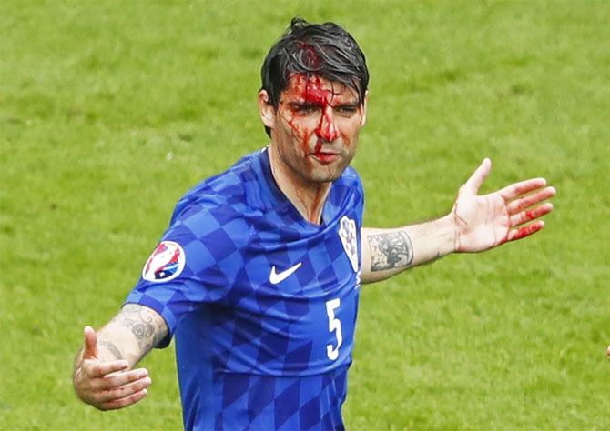 Croatia's Vedran Corluka waits for medical staff while covered in blood following a head injury during his match against Turkey in Paris on Sunday