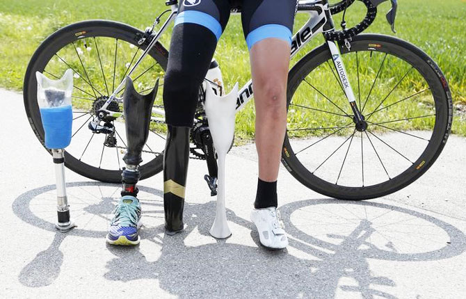 German paralympic cycling athlete Denise Schindler poses with her bicycle and her different artifical legs