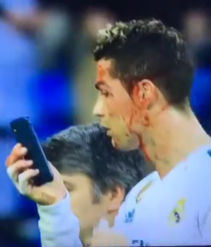 Cristiano Ronaldo checks his bloodied face in the phone cam