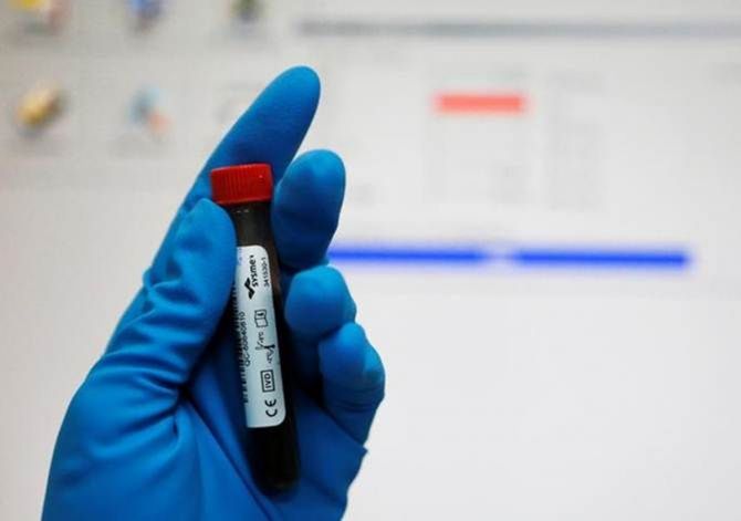 The WADA first suspended NDTL in August 2019 for six months and extended the de-recognition period after its inspections showed that non-conformities still existed.
