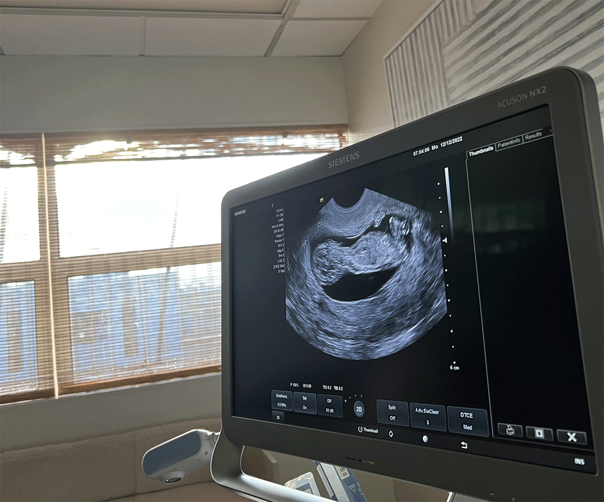 A scan showing Naoami's Osaka's pregnancy